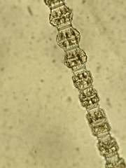 Desmidium