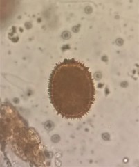 Trachelomonas armata