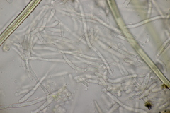 Rhexocercosporidium bellocense