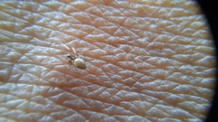 Clubionidae