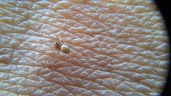 Clubionidae