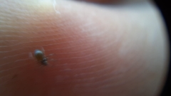 Clubionidae