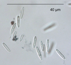 Pseudophaeophleospora atkinsonii