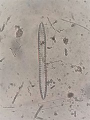 Surirella grunowii