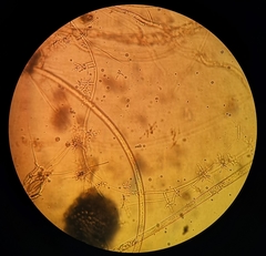 Trichoderma asperellum