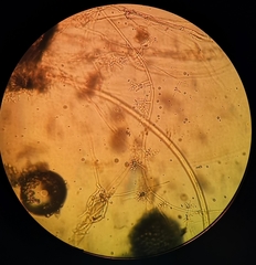 Trichoderma asperellum