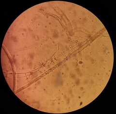 Trichoderma asperellum