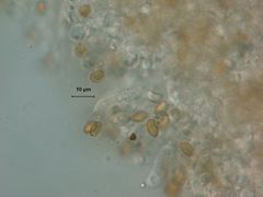Glaucopodes
