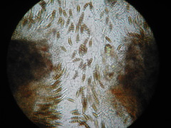 Seiridium pezizoides