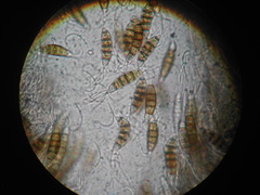 Seiridium pezizoides