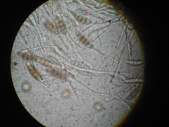 Seiridium pezizoides