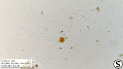 Haematococcaceae