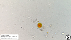 Haematococcaceae