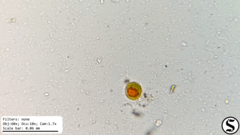 Haematococcaceae