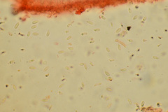 Resinomycena montana