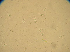 Pleurotus parsonsiae