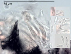 Mycosphaerella cunninghamii