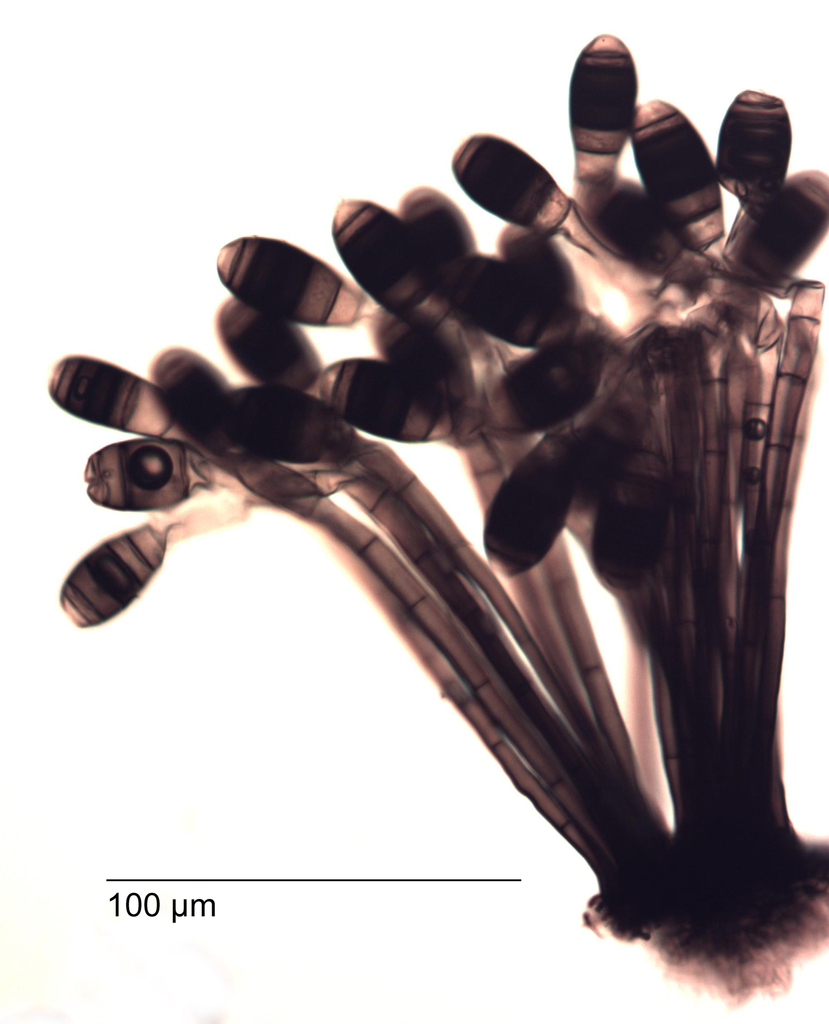 Phragmocephala