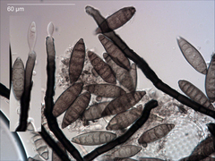 Pseudospiropes simplex