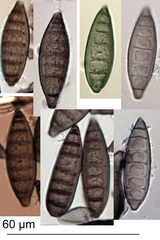 Pseudospiropes simplex