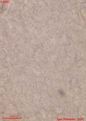 Orbilia phragmotricha