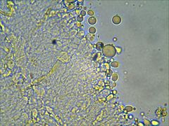 Pseudoomphalina compressipes