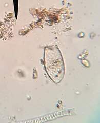 Euglypha