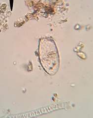 Euglypha