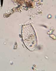 Euglypha