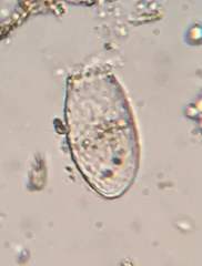 Euglypha