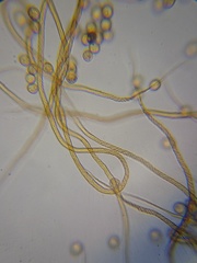 Trichia crateriformis