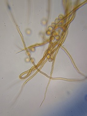 Trichia crateriformis