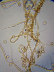 Trichia crateriformis