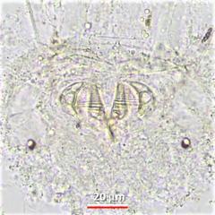 Testudinella clypeata