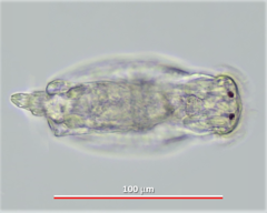 Testudinella clypeata