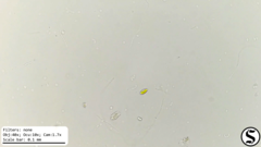 Chlorogonium