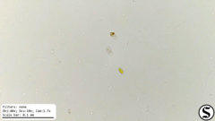 Chlorogonium