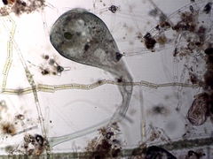 Stentor coeruleus