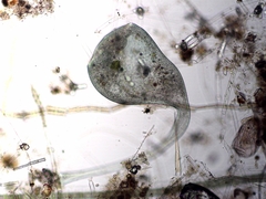 Stentor coeruleus