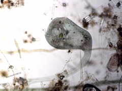 Stentor coeruleus