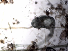 Stentor coeruleus