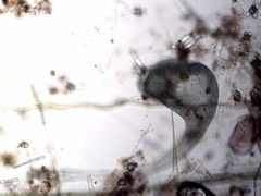 Stentor coeruleus