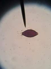 Trichuris vulpis