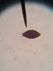 Trichuris vulpis