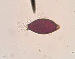 Trichuris vulpis