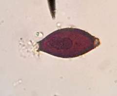 Trichuris vulpis