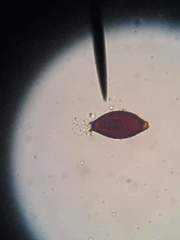 Trichuris vulpis