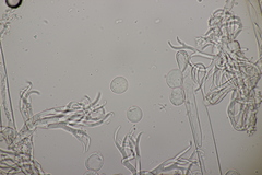 Hyaloperonospora sisymbrii-loeselii