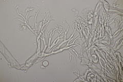Hyaloperonospora sisymbrii-loeselii