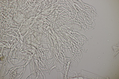 Hyaloperonospora sisymbrii-loeselii